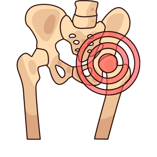 Hip Replacement Surgery in India